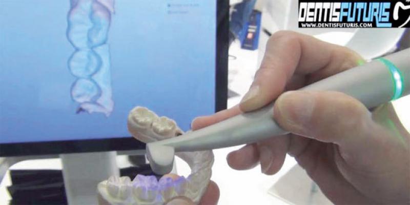 Santé: Les enjeux de la dentisterie numérique