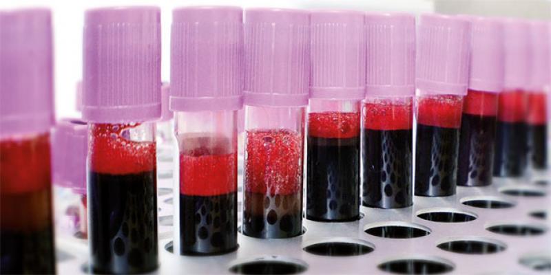 Transfusion sanguine: Le rapport accablant de la mission parlementaire