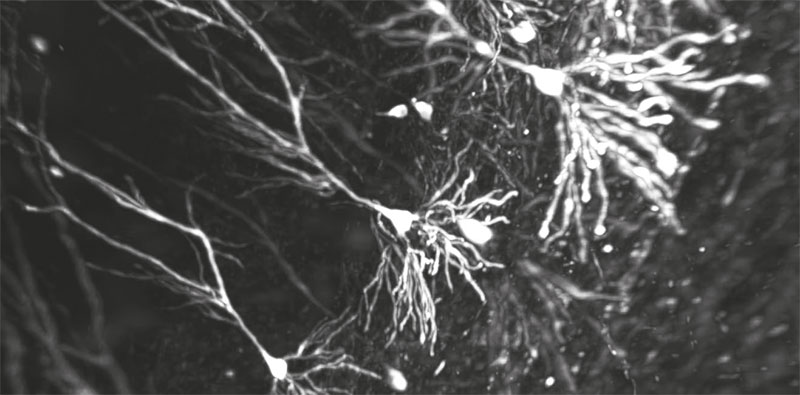 neurones-de-lhippocampe-059.jpg